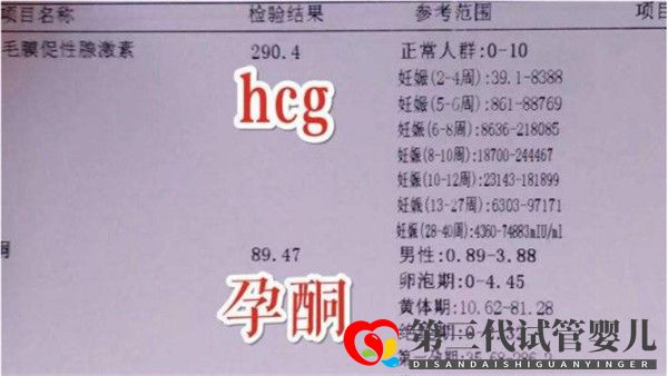 通過試管嬰兒移植后多久可以驗孕驗孕成功后多久可以測胎心(圖1) 通過試管嬰兒移植后多久可以驗孕驗孕成功后多久可以測胎心(圖1)