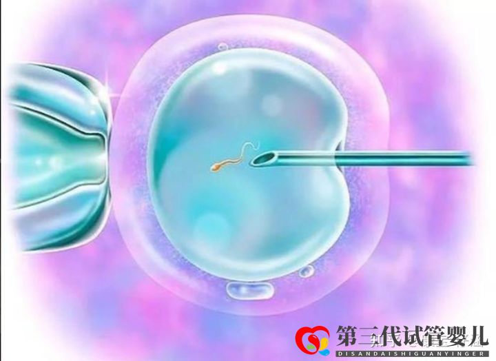 通俗易懂的一、二、三代試管嬰兒解說(shuō),及三代試管能...(圖4)