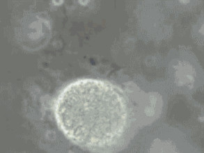 精子碎片率高可以做三代試管嬰兒嗎？(圖1)