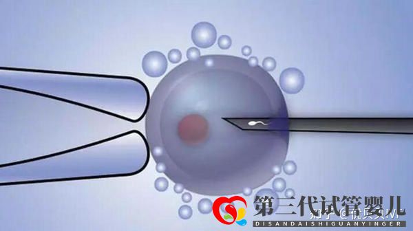 國內(nèi)的三代試管醫(yī)院都有哪些第一梯隊(duì)了解下(圖3) 國內(nèi)的三代試管醫(yī)院都有哪些第一梯隊(duì)了解下(圖3)