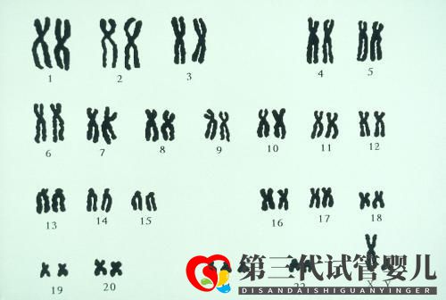 夫妻染色體正常，試管胚胎染色體異常的三個原因你都知道嗎？(圖1)