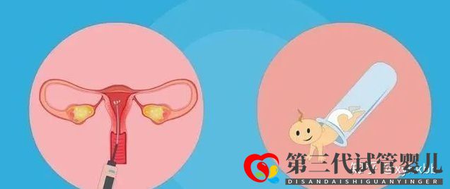 國(guó)內(nèi)第三代試管嬰兒可以選擇性別嗎心悅告訴你(圖2)