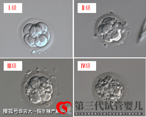 胚胎能看出來男女嗎？(圖1)