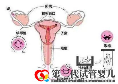 人工授精跟試管嬰兒的區(qū)別(圖10) 人工授精跟試管嬰兒的區(qū)別(圖10)