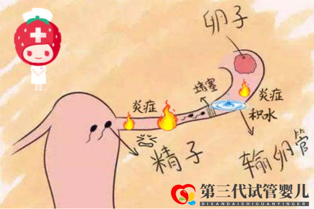 報(bào)喜萬(wàn)家！輸卵管積水的她放棄做試管，卻憑一劑中藥喜獲“好孕”(圖1)