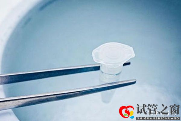 一文帶你了解試管嬰兒整個流程個各個環(huán)節(jié)時(shí)間節(jié)點(diǎn)的...(圖3)