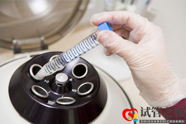 全部試管嬰兒助孕全過(guò)程是怎么操作的(圖1)