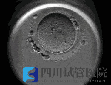 成都試管嬰兒醫(yī)院引進“時差培養(yǎng)箱”，助力篩選更具發(fā)育潛力的胚胎(圖2)