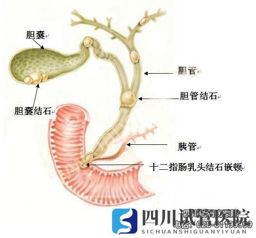 四川結(jié)石病醫(yī)院等級專業(yè)品牌平價(jià)透明費(fèi)用統(tǒng)一規(guī)范(圖3)