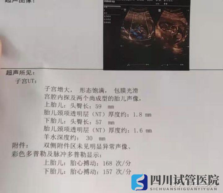 我在成都做三代試管的經(jīng)歷(標圖接好孕)(圖5) 我在成都做三代試管的經(jīng)歷(標圖接好孕)(圖5)