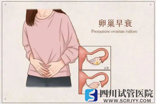 5個信號暗示卵巢早衰(圖1)