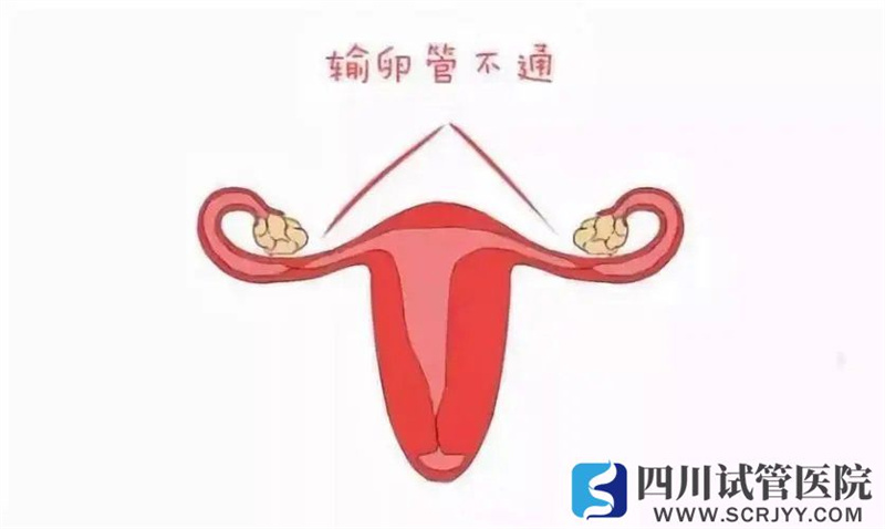 輸卵管的這兩項(xiàng)功能對(duì)懷孕至關(guān)重要，怎么知道它好不好？(圖1)