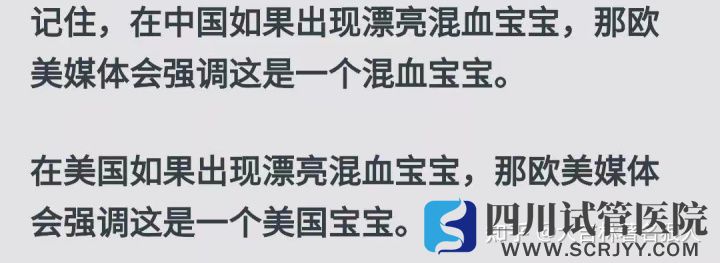 美國(guó)34%的混血兒患精神障礙_一文顛覆你對(duì)混血寶寶...(圖15)
