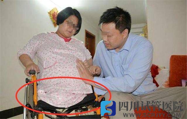 “無腿”媽媽試管生下雙胞胎，如今5年過去，一家人現狀如何？(圖1)